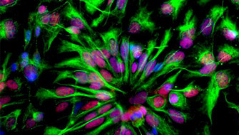 Kök Hücre Çalışmalarının Erkek Kısırlığı Tedavisindeki Yansımaları